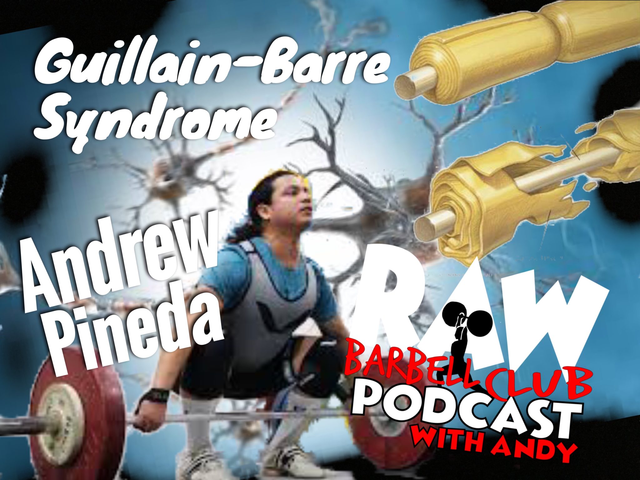 Andrew Pineda : Guillain–Barré Syndrome